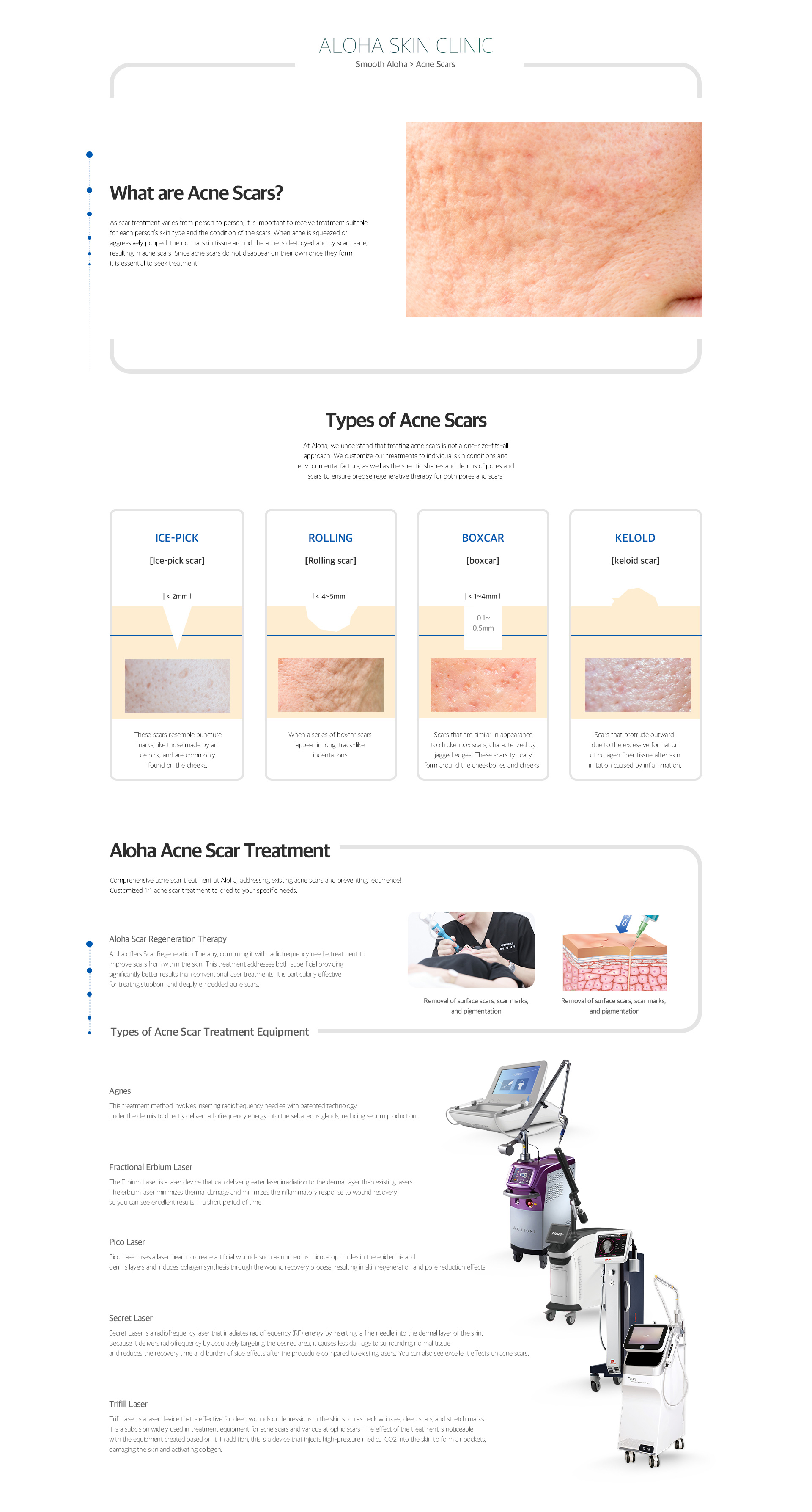 Acne scars