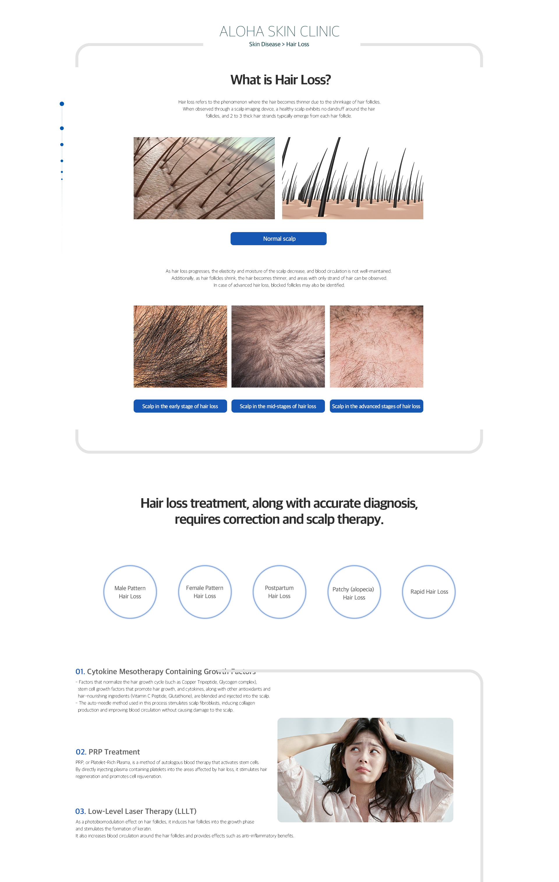 Hair loss
